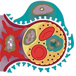 Nephrotic Syndrome