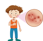 Skin Psoriasis