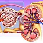 Albuminuria